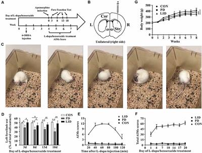 Brain-Region Specific Metabolic Abnormalities in Parkinson’s Disease and Levodopa-Induced Dyskinesia